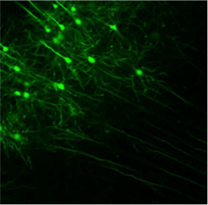 Overactive neurons in the front of the mouse brain, shown in green, trigger excessive release of the brain chemical dopamine, which causes motor abnormalities. Credit: Soderling lab, Duke University