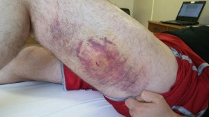 accidental-shooting-1-jpg