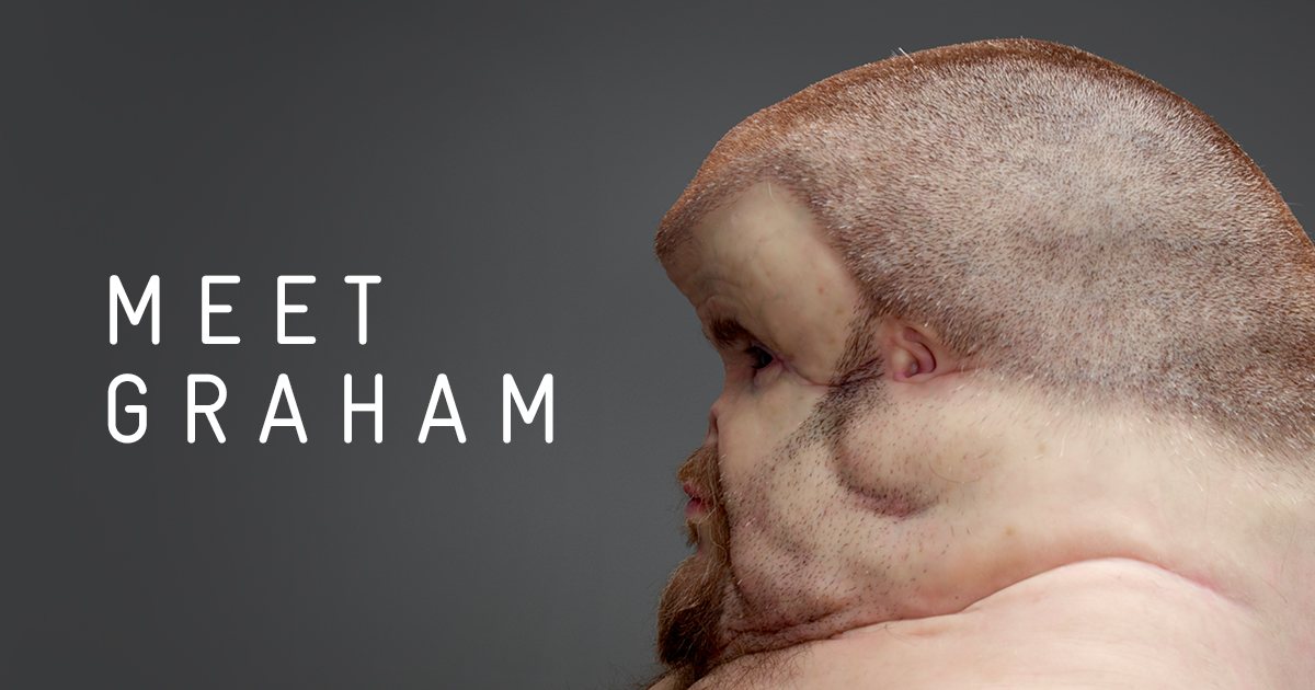 Meet Graham, a Human Evolved to Survive a Car Crash | Stannous Flouride ...